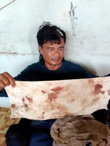 Diduga Preman Bayaran PT SBP Aniaya Petani, Kepala Sobek hingga 14 Jahitan